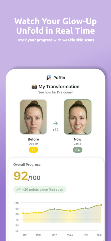 Puffin: Acne Tracker - Ein Vorher-Nachher-Vergleich der Hauttransformation und eine Fortschrittsgrafik des Haut-Scores in der Puffin App-Oberfläche.