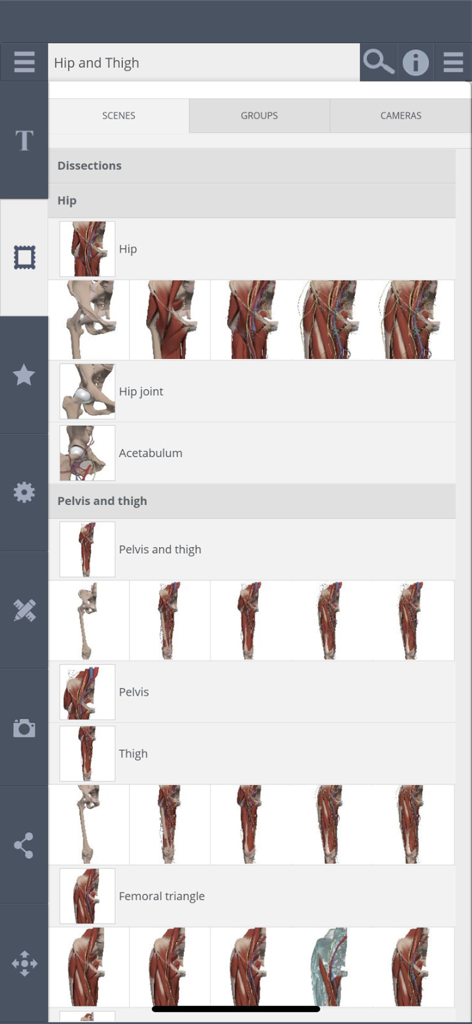 Primal's 3D Hipアプリの、プリセットされた解剖学的シーンのギャラリー。