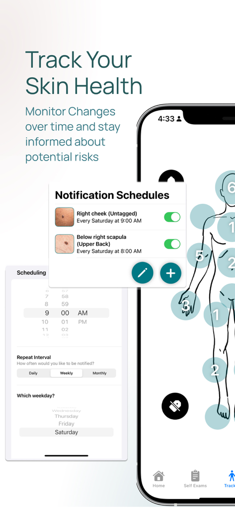 Skin-Check app interface displaying a body map and notification schedules for monitoring skin spots