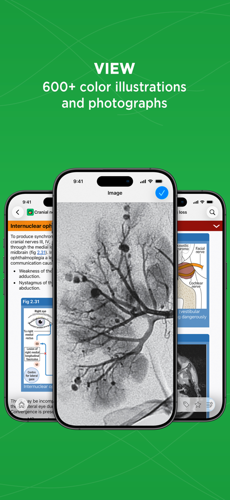 Oxford Handbook Clinical Med - iPhone 화면에 의료 삽화 및 임상 사진을 표시하는 옥스퍼드 임상 의학 핸드북 앱.