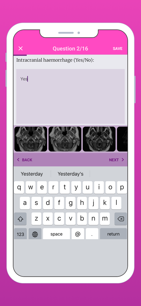 EDiR App - Pregunta de práctica de examen de radiología en la aplicación EDiR con imágenes médicas escaneadas