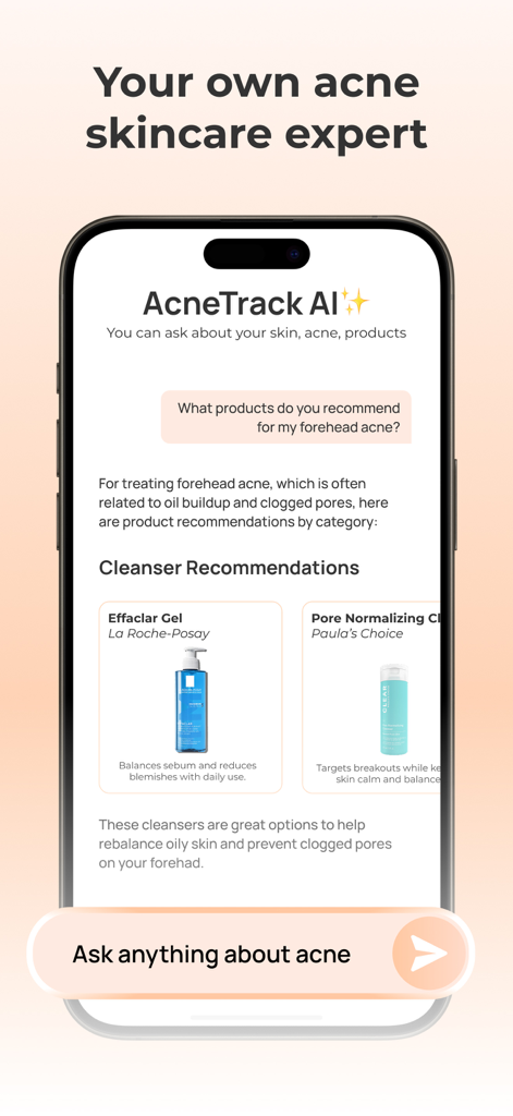 AcneTrack – Your Acne Journey - Chatbot AI di AcneTrack che fornisce raccomandazioni personalizzate di prodotti per la cura della pelle per l'acne sulla fronte.