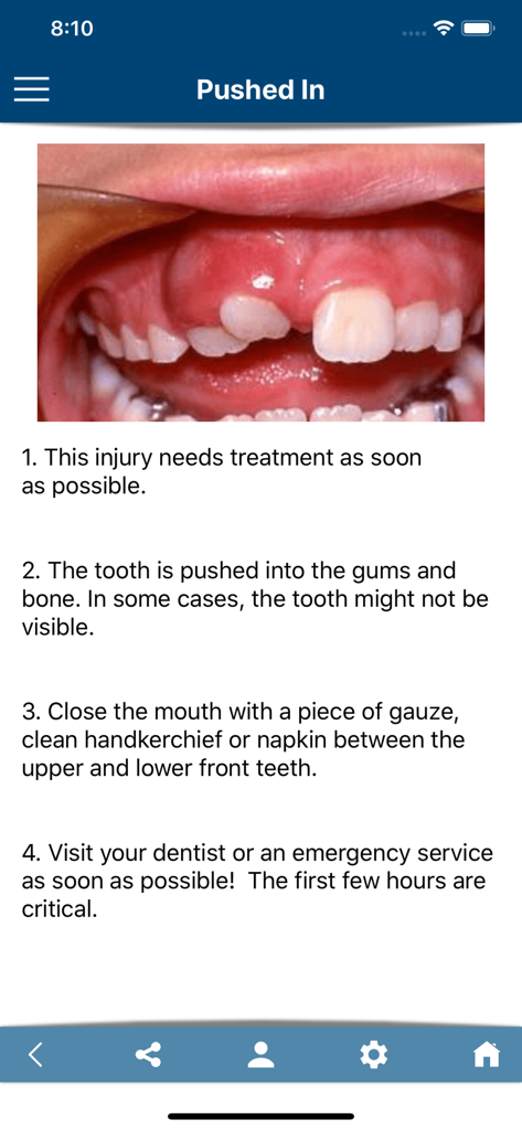 Emergency care steps for a tooth pushed into the gums on the ToothSOS app
