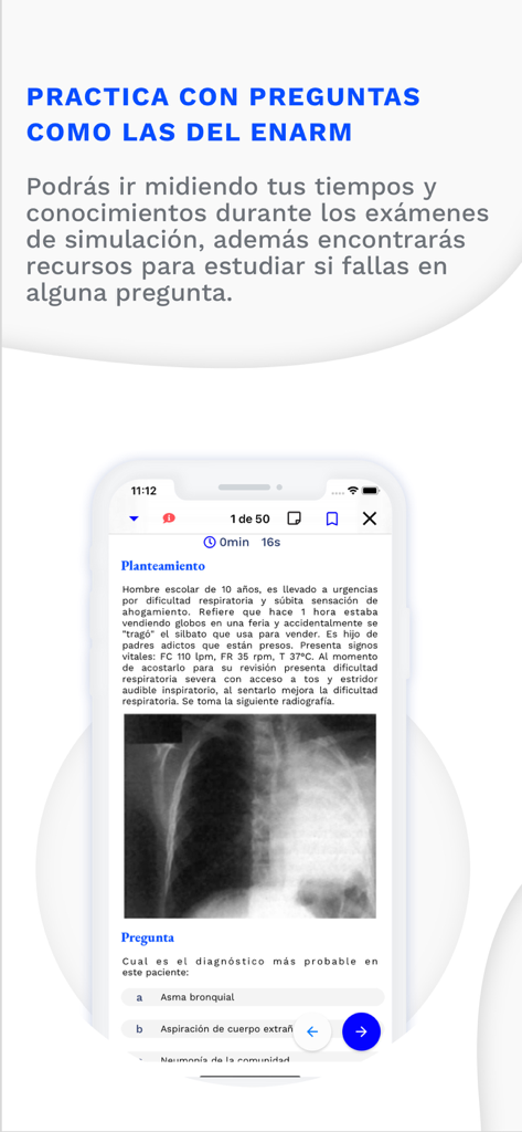 Mobile screen showing a medical practice question with a clinical case and X-ray for ENARM preparation.
