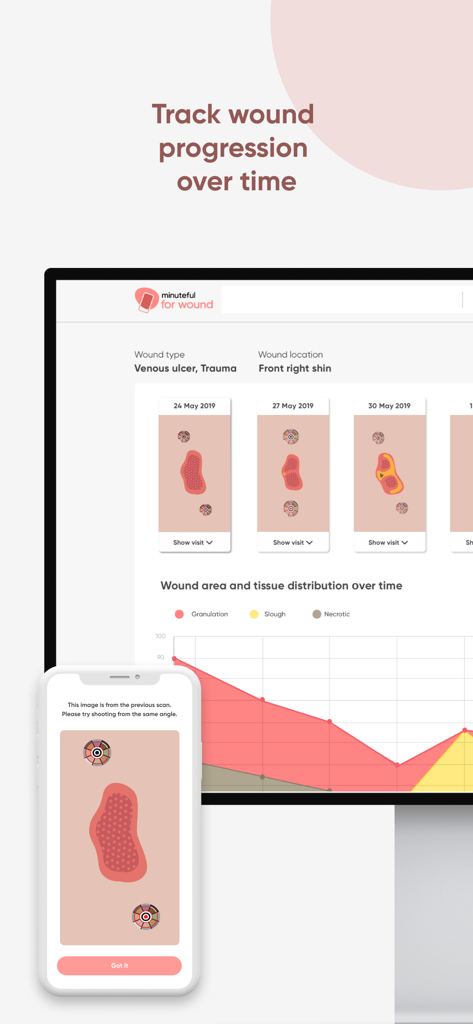 Minuteful for Wound - Digital dashboard and smartphone app showing wound healing progress over time with clinical data and charts