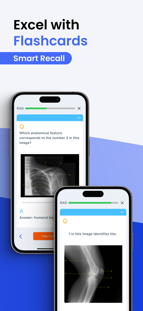 Prepry - Radiography Exam Prep - Radiography exam preparation flashcards showing X-ray images and anatomical questions on a mobile app interface