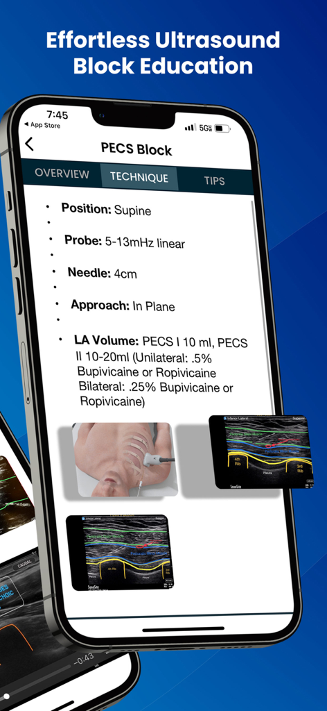 PNBschool Anesthesia Blocks | Master Ultrasound-Guided Nerve Blocks