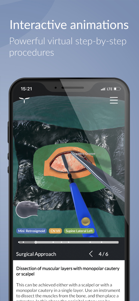 UpSurgeOn Neurosurgery - Interactive 3D neurosurgery animation showing a step by step surgical approach on a smartphone