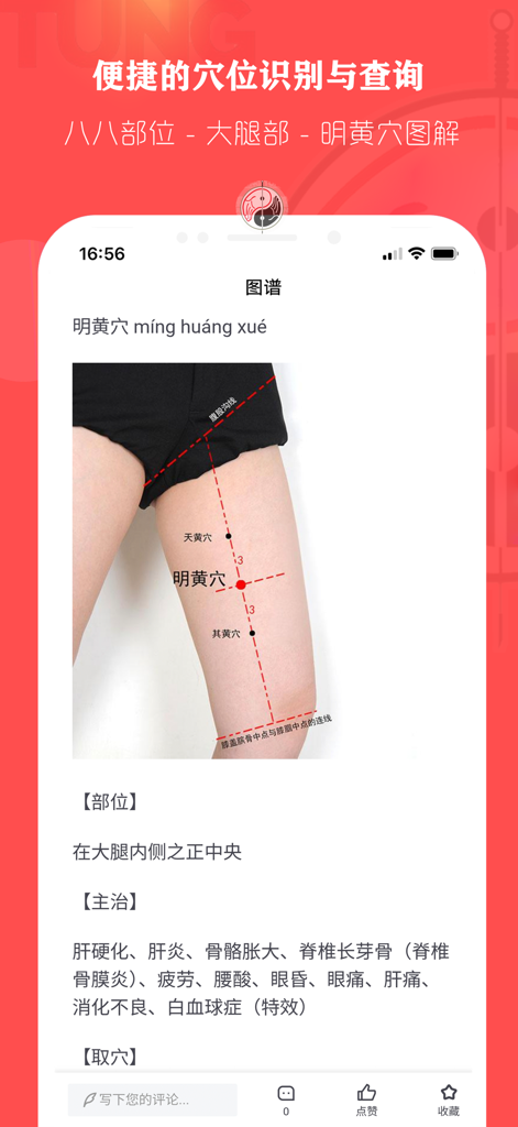 Anatomical diagram of Master Tung acupuncture points on the thigh within a medical app.