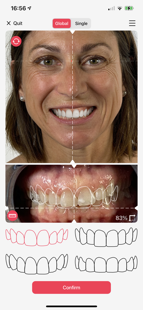 Hybridge Smile Design - Medical App | MWM