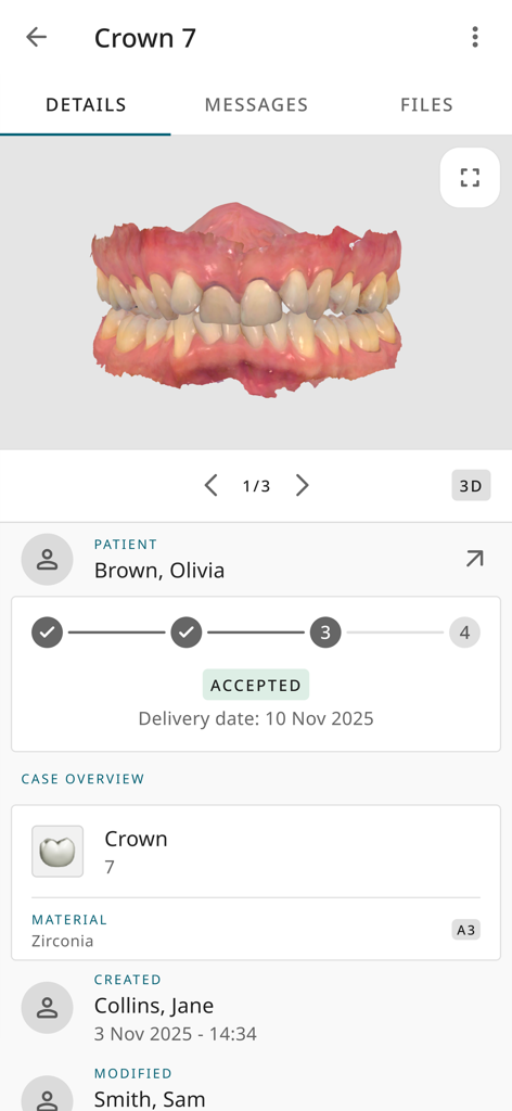 3Shape Unite Cloud - A 3D dental scan and case overview for a crown procedure displayed in the 3Shape Unite Cloud mobile app interface.
