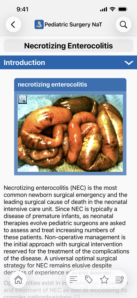Medical app screen showing a clinical module for Necrotizing Enterocolitis with an anatomical image and surgical description