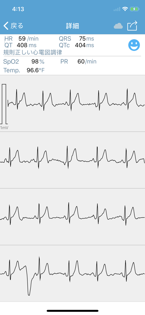 Forma de onda de ECG detallada y mediciones de salud como la frecuencia cardíaca y SpO2 en la aplicación Checkmee Advance