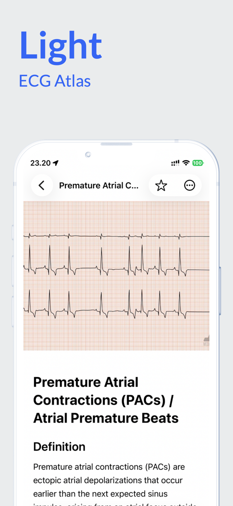 Die Benutzeroberfläche der EKG Atlas App zeigt einen vorzeitigen Vorhofkontraktion Rhythmusstreifen und medizinische Definition.