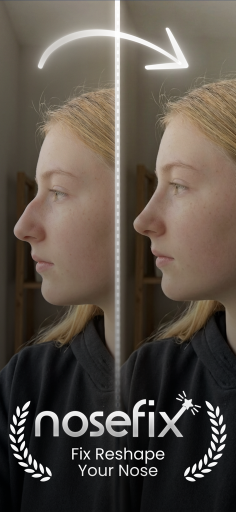 Comparaison avant et après d'un profil de nez utilisant l'outil de simulation d'IA Nosefix