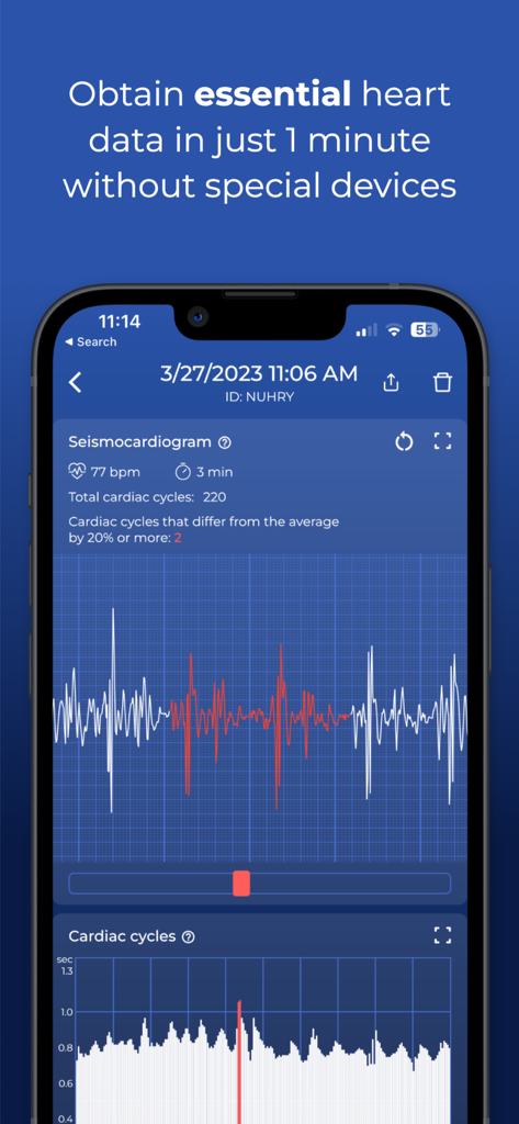 HeartScan: Heart Rate Monitor - La aplicación HeartScan muestra un gráfico detallado de sismocardiograma y estadísticas de frecuencia cardíaca en un iPhone