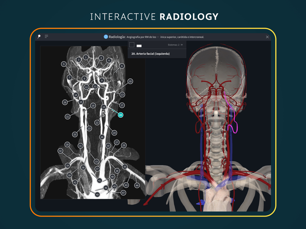 Interactive radiology interface comparing an MRI scan with a 3D anatomical model of the human head and neck.