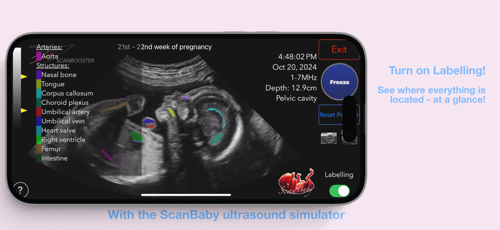 ScanBaby app ultrasound simulator showing labeled fetal anatomy at 22 weeks of pregnancy
