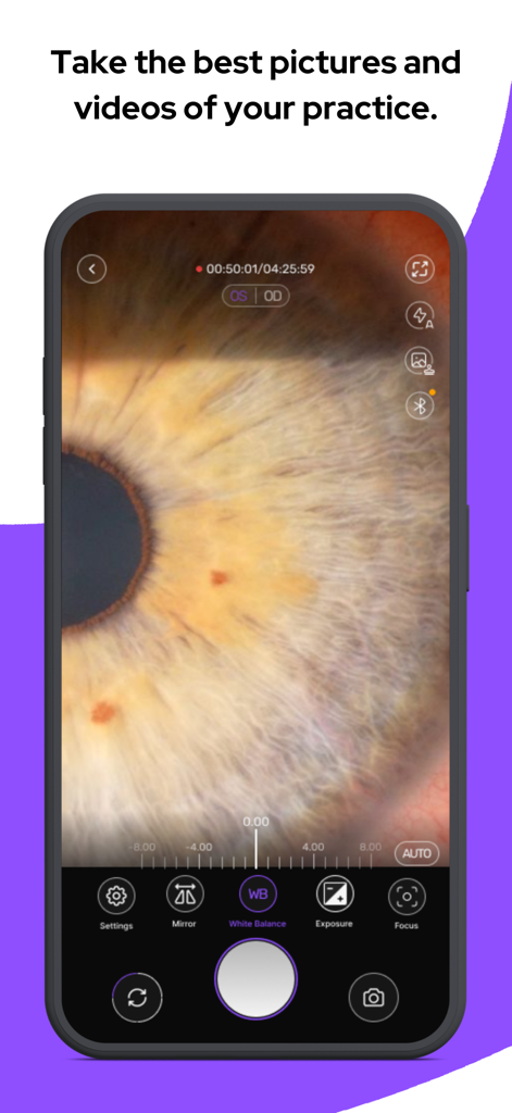 MicroREC App - MicroREC App interface displaying a high-resolution microscopic image of a human eye with manual camera controls for clinical documentation