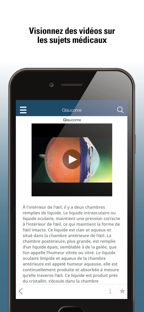 Le Manuel MSD Professionnel - Une vidéo médicale sur le glaucome affichée sur un smartphone au sein de l'application Le Manuel MSD Professionnel.