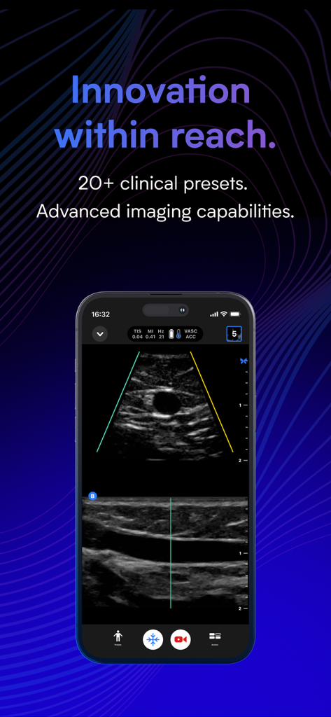 Smartphone displaying Butterfly iQ ultrasound app with advanced clinical imaging presets