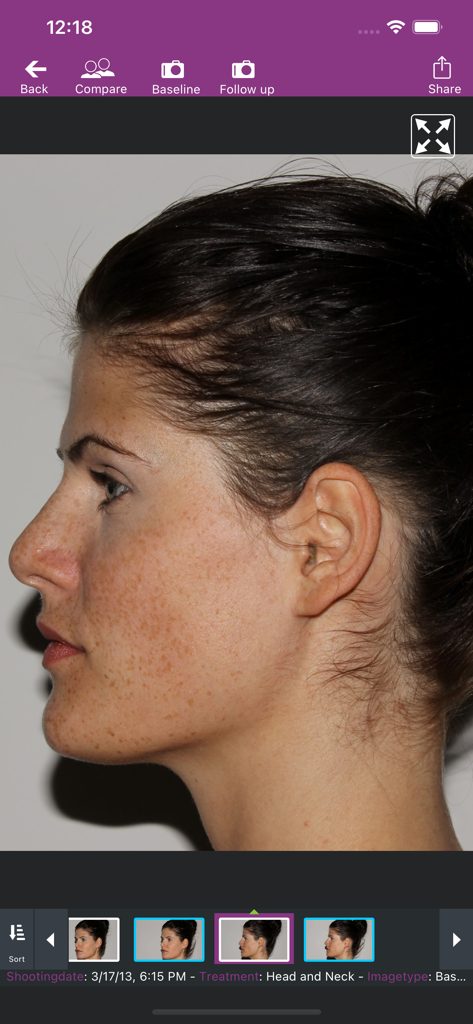 meesma - Professional profile skin imaging of a patient in the Meesma aesthetic app interface.