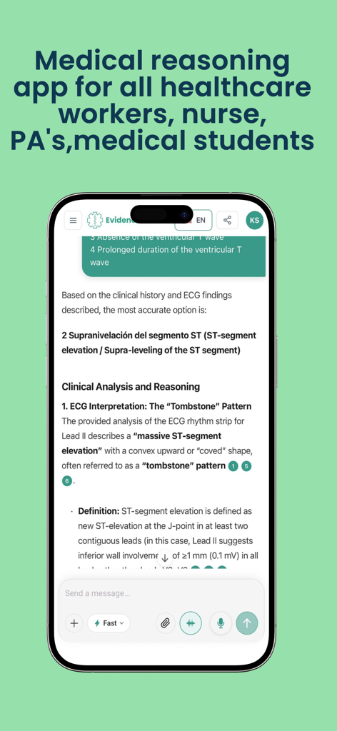 EvidenceMD- Medical Reasoning - EvidenceMD app interface displaying clinical analysis and medical reasoning for an ECG interpretation