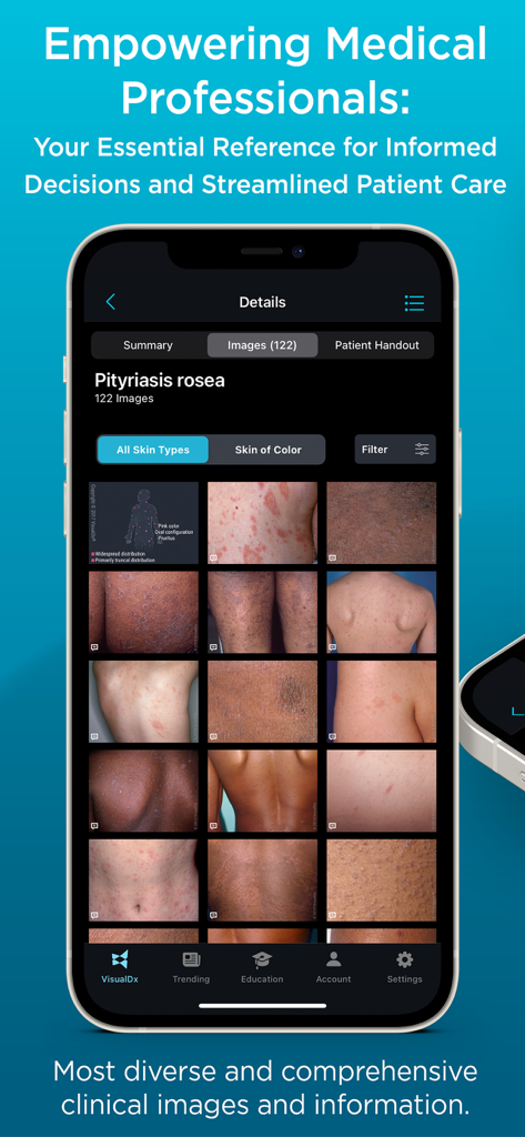 VisualDx - Interfaz de la aplicación VisualDx que muestra una galería de imágenes clínicas para Pitiriasis rosada en diversos tonos de piel