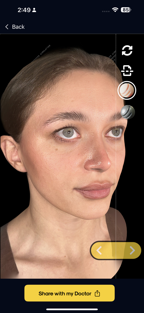 Kratos Surgery - A high resolution 3D facial scan inside the Kratos Surgery app interface with a button to share the simulation with a doctor