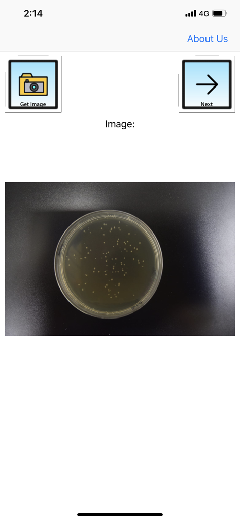 APD Colony Counter App Lite - APD Colony Counter App Lite Benutzeroberfläche, die eine Agarplatte mit Bakterienkolonien zur Analyse anzeigt