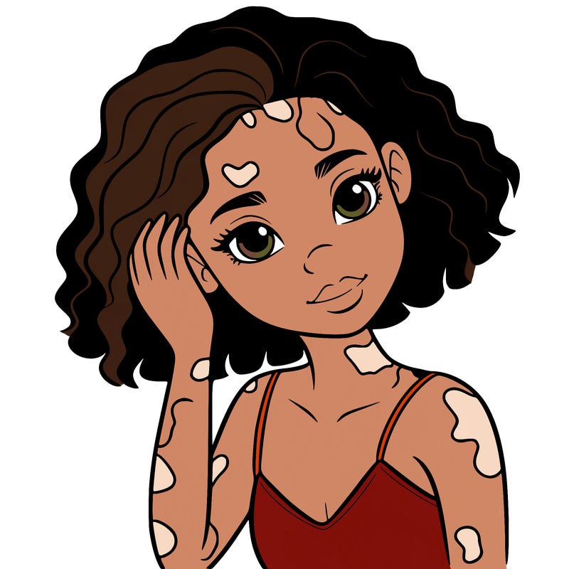 vitiligo black girl