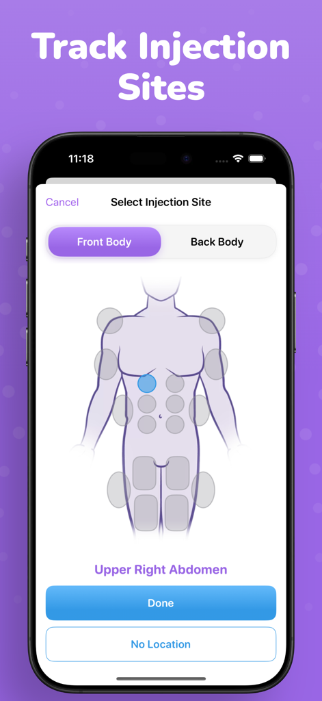 A mobile interface from PeptideKit showing a body diagram to select and track subcutaneous injection sites for peptide therapy protocols.