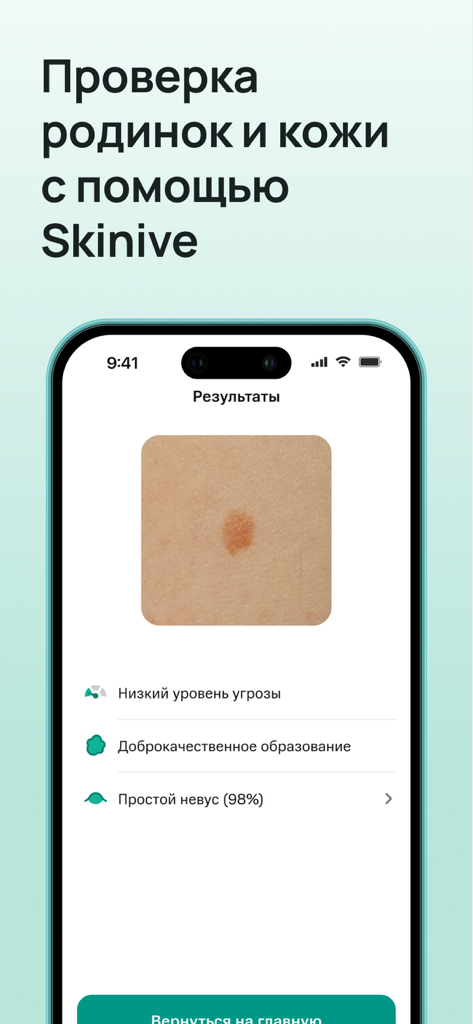 StoreMed - Здоровье онлайн - StoreMed app interface showing AI-powered skin and mole screening results