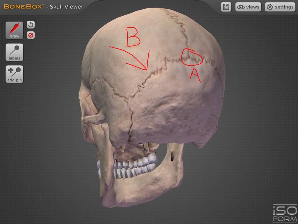 3D human skull model with red pen annotations for anatomy study in BoneBox app