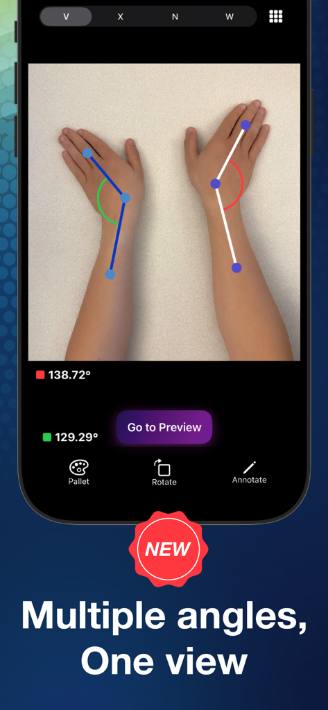 Angulus Pro - Precision Angle - Interface do aplicativo móvel Angulus Pro mostrando medições de ângulos de precisão simultâneas em dois braços para avaliação clínica.