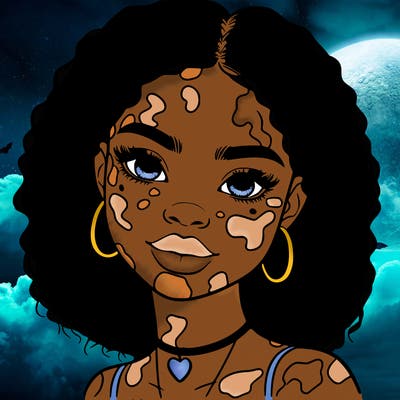 bleautiful black girl with vitiligo