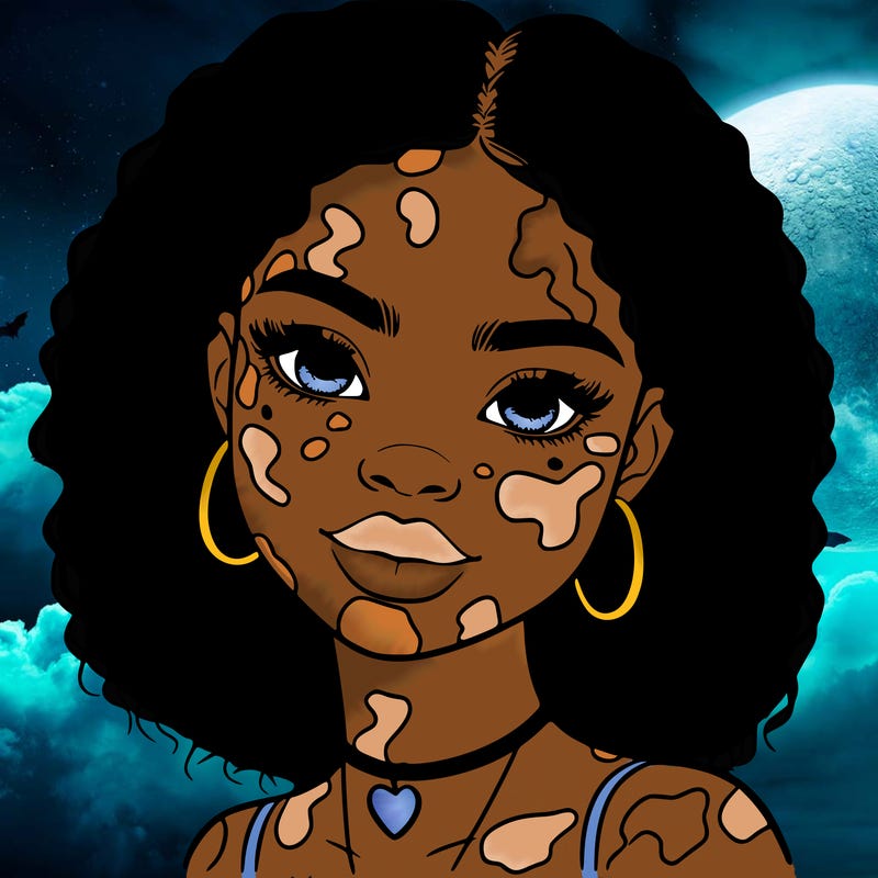 bleautiful black girl with vitiligo