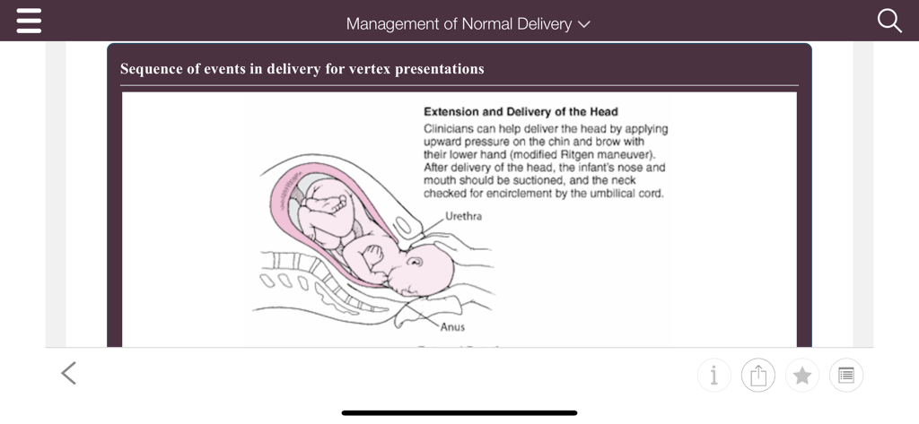 MSD Manual Guide to Obstetrics - Diagram of extension and delivery of the head from the MSD Manual Guide to Obstetrics.