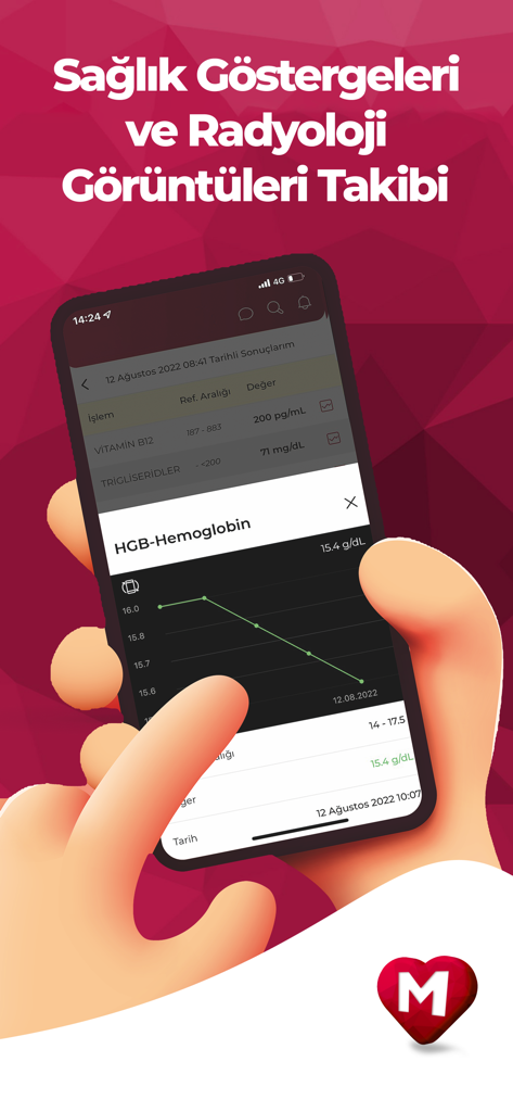 Smartphone displaying medical health tracking charts in the Memorial app