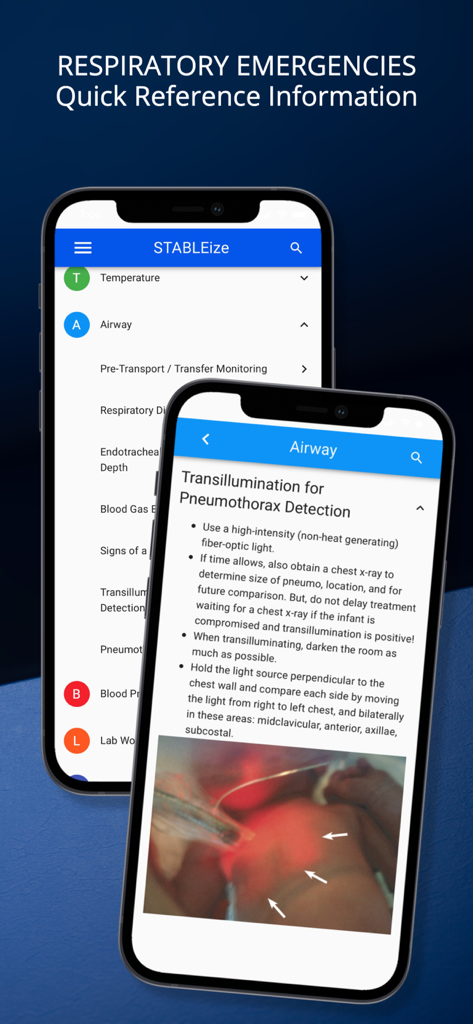 STABLEize - The STABLE Program - STABLEizeアプリの新生児気道管理ガイドラインと気胸検出のための透光検査を表示する2つのiPhone画面