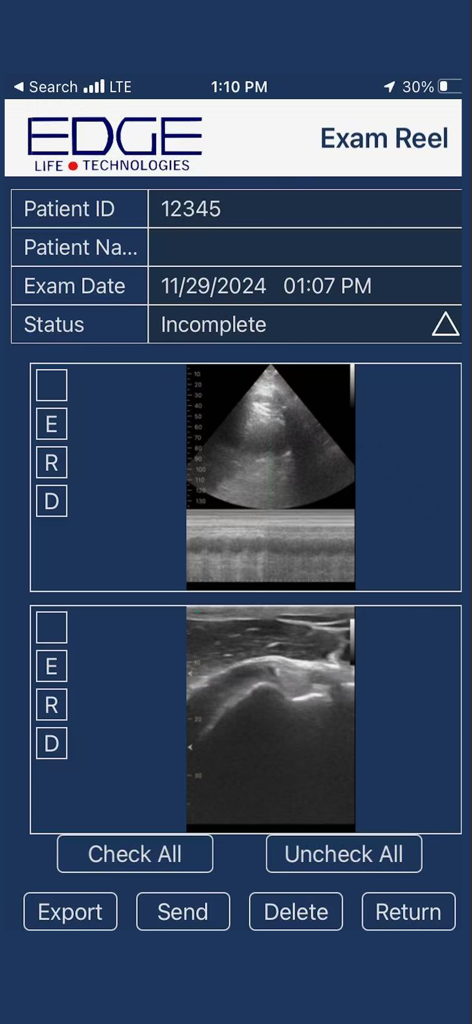 EdgeLife - La interfaz Exam Reel de la aplicación EdgeLife que muestra escaneos de ultrasonido guardados e información del paciente