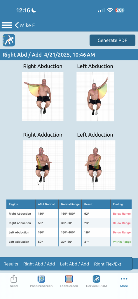 Shoulder range of motion assessment report in PostureScreen Mobile showing clinical measurements