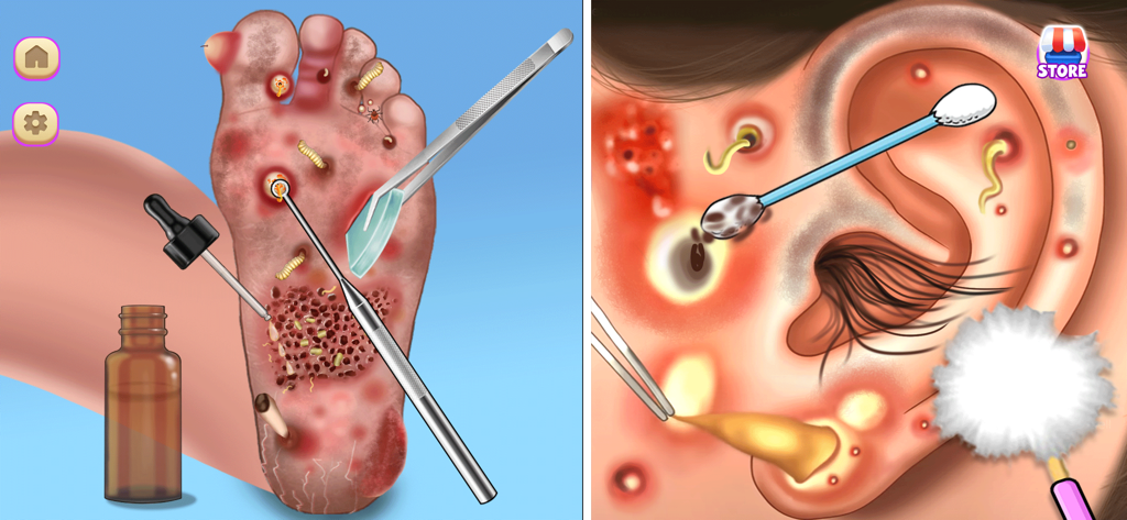 Skincare ASMR Makeover Games - Uma tela dividida mostrando tratamentos médicos para pés e ouvidos com ferramentas especializadas em um jogo de transformação ASMR