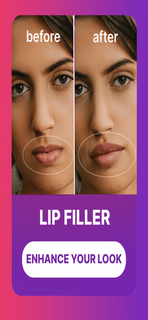 Pody Plastic Surgery Simulator - Before and after lip filler AI simulation in Pody Plastic Surgery Simulator