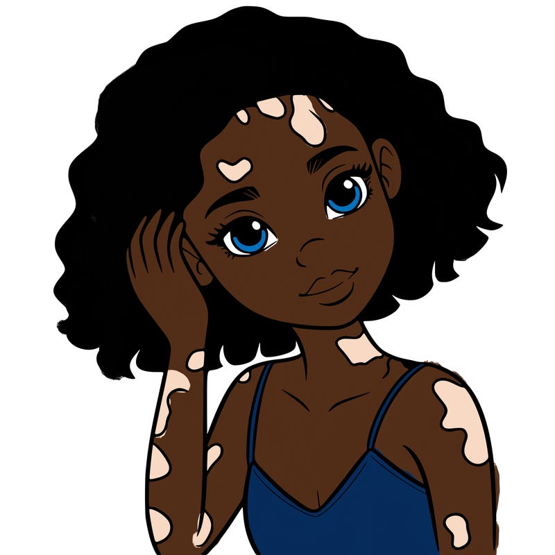 vitiligo black girl