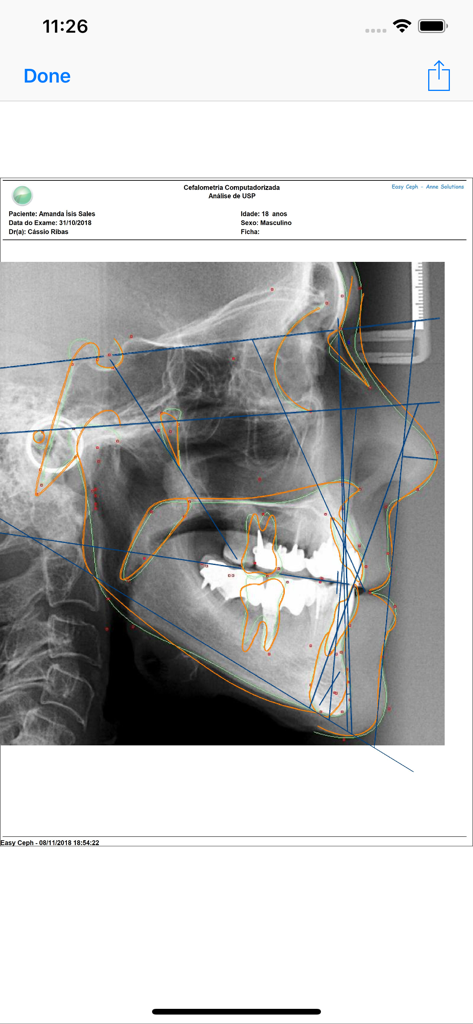 Easy Doc Anne Solutions - Affichage d'analyse céphalométrique informatisée sur l'application Easy Doc montrant une radiographie dentaire latérale avec des mesures orthodontiques