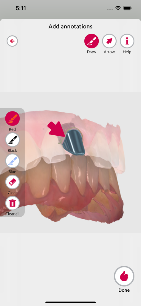 Annotation tool in 3Shape Communicate showing a 3D dental model with a red arrow pointer