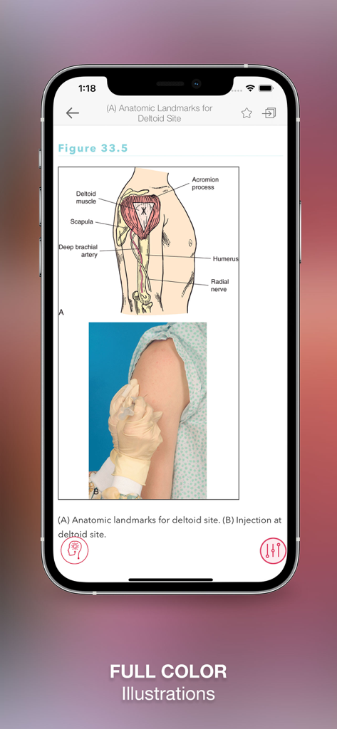 Nursing Skills & Procedures - Anatomical diagram and photo showing deltoid site landmarks and injection technique in the Nursing Skills and Procedures app