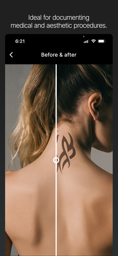 Camera Overlay for Business - Geteilter Bildschirm, der Vorher-Nachher-Vergleiche für medizinische und ästhetische Verfahren zeigt