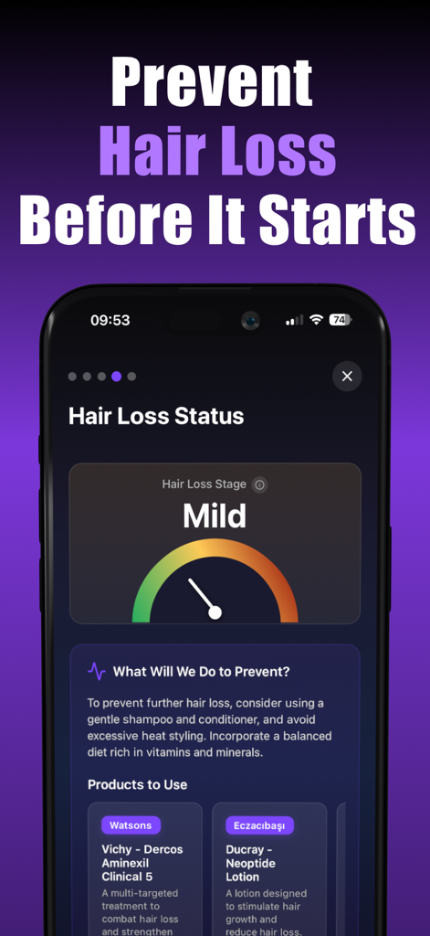AI hair loss status report screen showing a mild hair loss stage gauge and personalized prevention advice